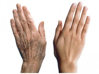 Indications for contouring hands