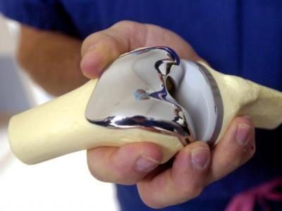 Total knee arthroplasty