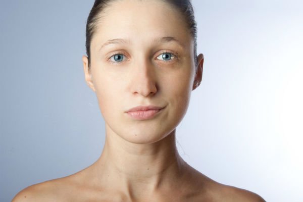 Face Asymmetry: Causes