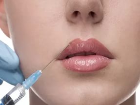 Lip correction procedure with hyaluronic acid