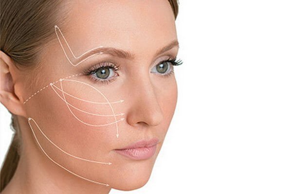 How is facial lipofilling performed?