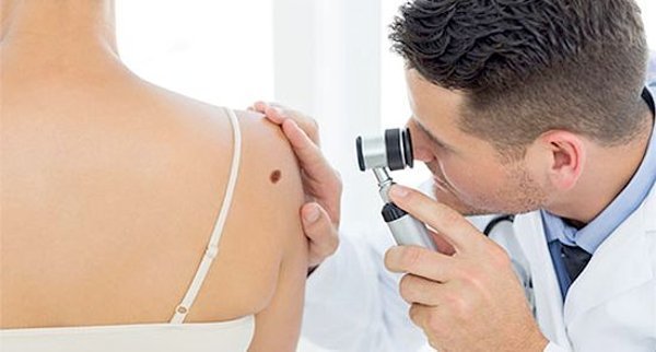 Examination by a dermatologist