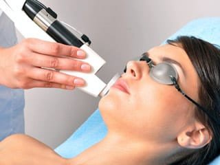 Laser hair removal