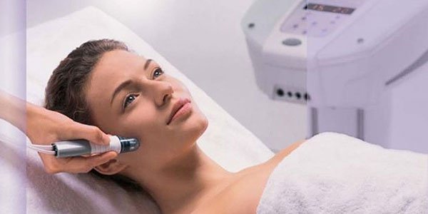 Laser facial hair removal