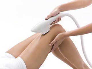 Laser hair removal