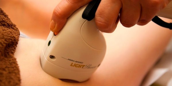 Diode laser hair removal