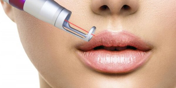 Lip tattoo removal