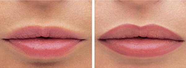 Before and after tattooing lips