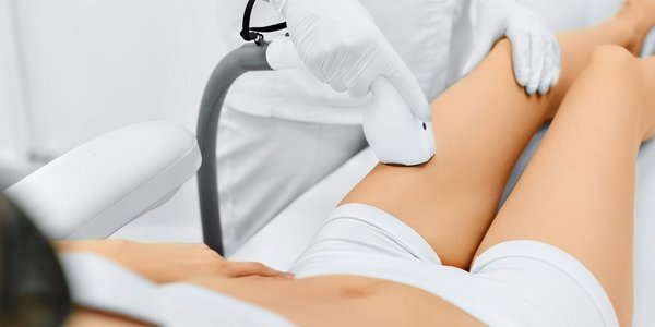 ELOS laser hair removal