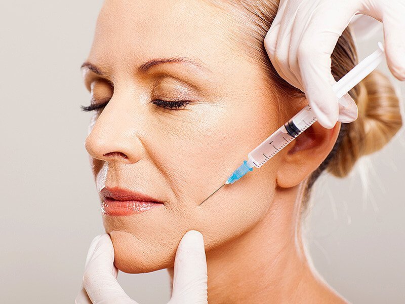 Facial rejuvenation fillers