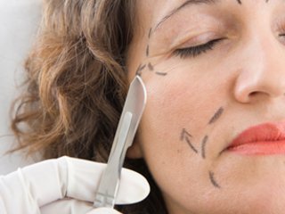 How is the plastic surgery facelift