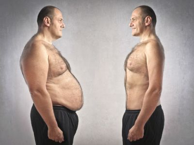 Abdominal fat cutting operation