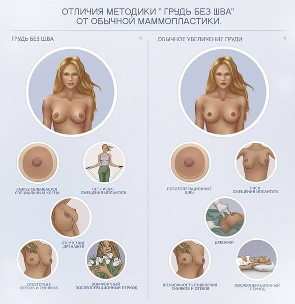 The process of performing mammoplasty through the armpit