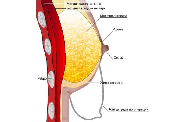 Breast structure