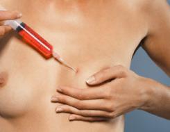 Endoscopic breast lift