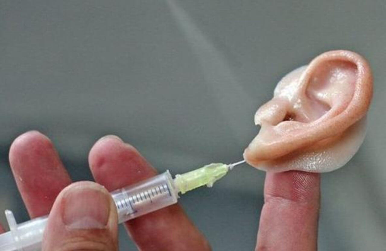 Ear bioprosthesis