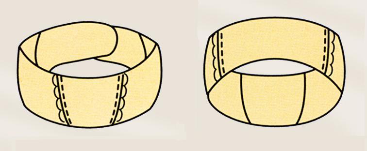 Compression bandage on the ears after otoplasty