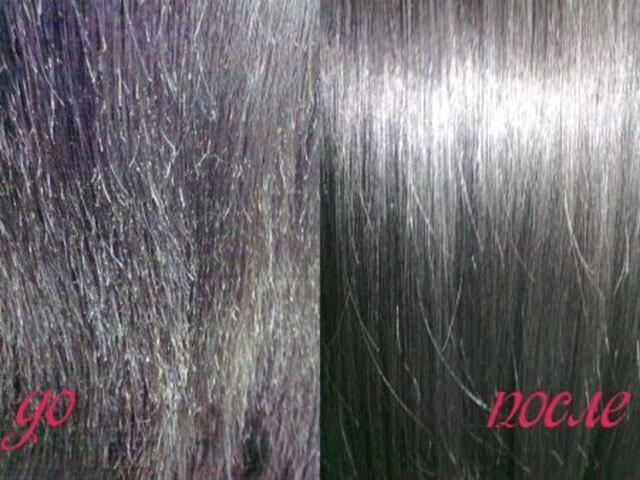 Before and after keratin hair prosthetics