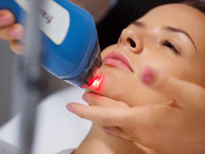 Contraindications for laser scar grinding